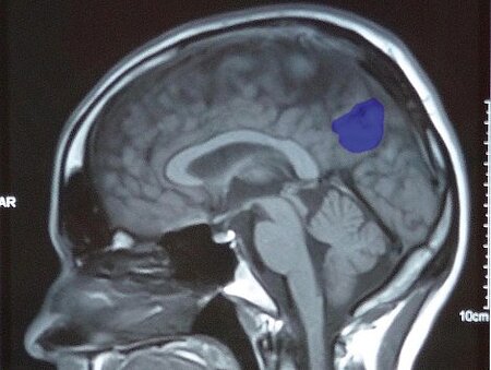Using insights gained from brain research for technical documentation