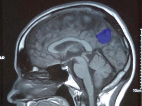 Using insights gained from brain research for technical documentation